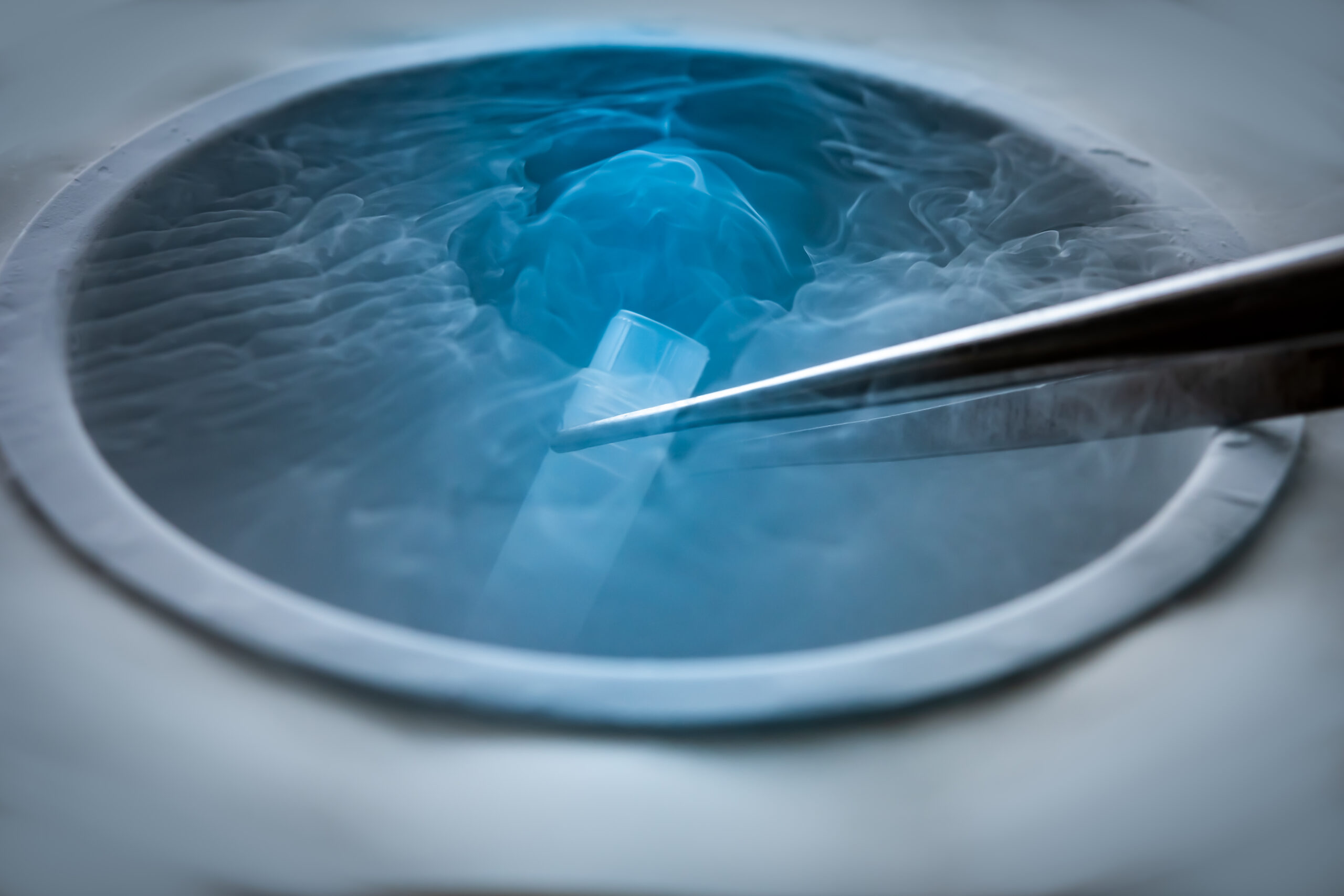 Cryogenic storage vial being lifted from a liquid nitrogen tank with forceps, surrounded by vapor, representing precise cell cryopreservation.